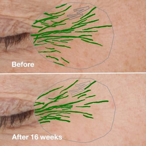 Clinique Smart Clinical Repair Wrinkle Correcting Serum serum proti gubam 50 ml za ženske Cene