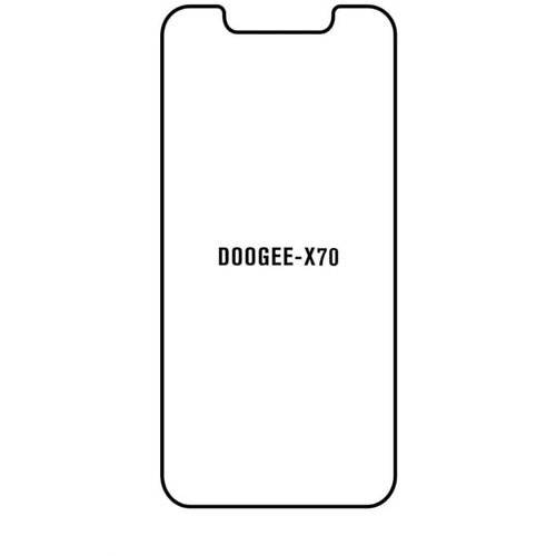 Doogee X70 hydrogel za&amp;scaron;titna folija Slike