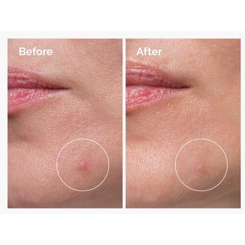 The Ordinary Sulfur 10% Powder-to-Cream Concentrate lokalna nega proti aknam 5 g Slike