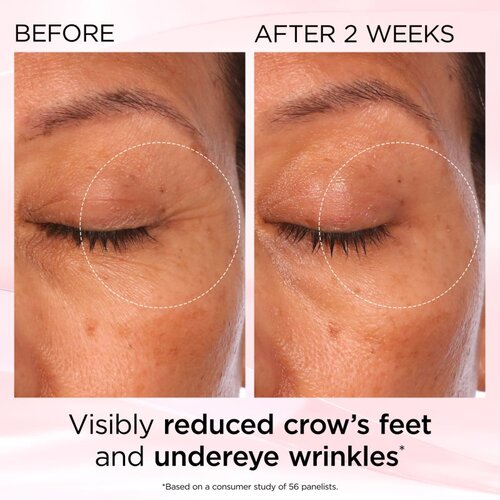 Elizabeth Arden Retinol + HPR Ceramide RAPID SKIN RENEWING EYE CREAM krema za zaglađivanje i posvjetljivanje područja oko očiju 15 ml Slike